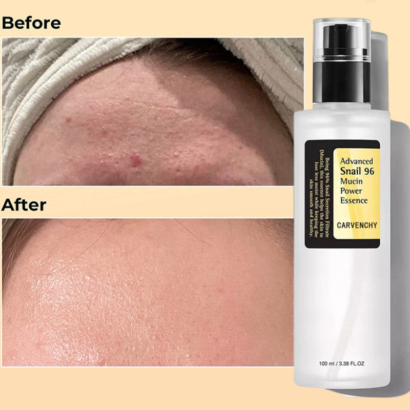 Snail Serum Collagen Facial Serum Original - Touch of Essence Beauty Bar