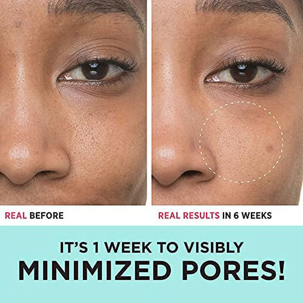 1 Week & Exfoliates to Help Refine Skin’S Texture